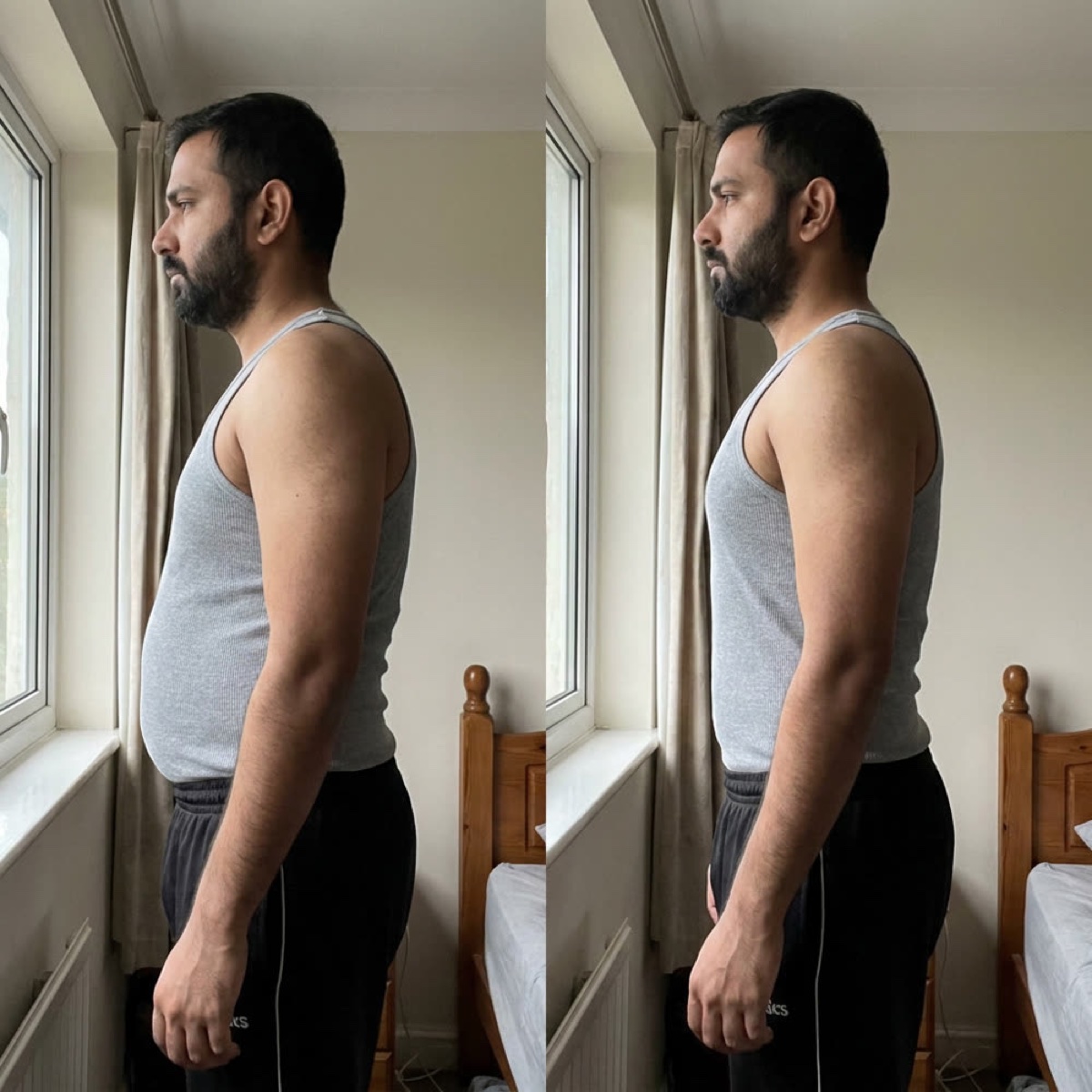 Deepak before and after
